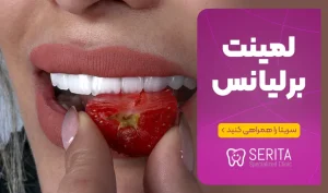 لمینت برلیانس