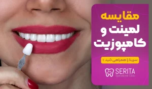 فرق لمینت و کامپوزیت دندان؟