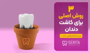 بهترین روش ها برای کاشت دندان