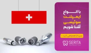 قیمت انواع ایمپلنت سوئیسی + بررسی برند