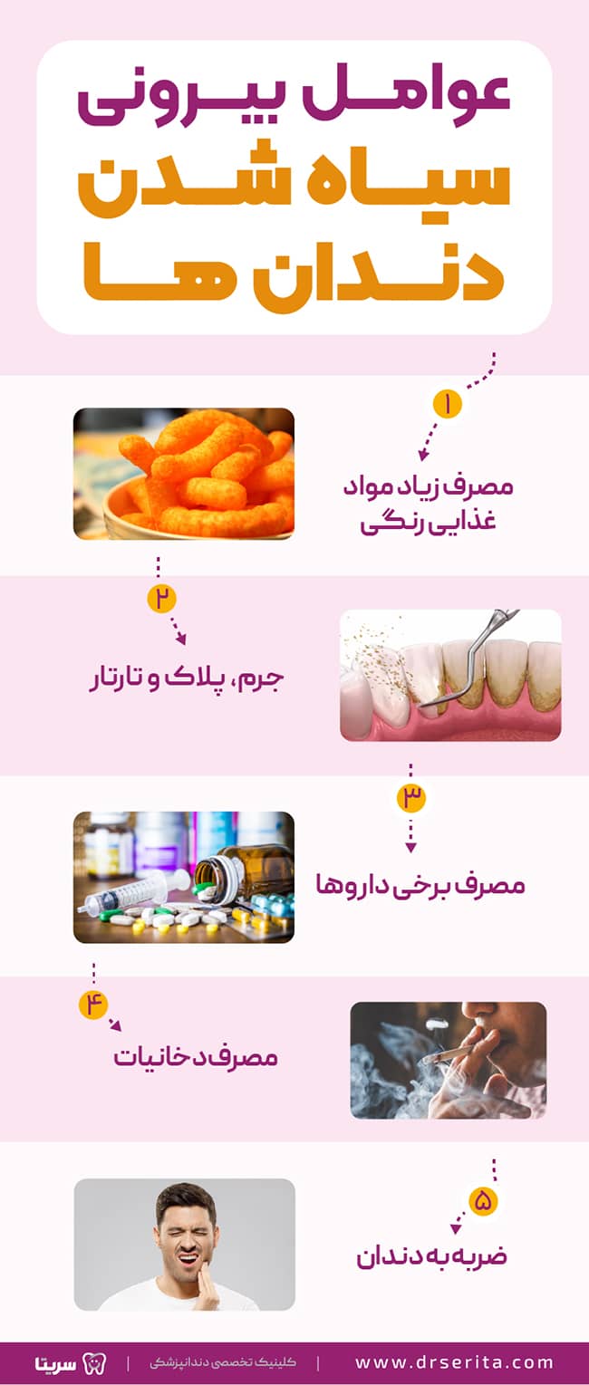 5 عامل خارجی سیاه شدن دندان ها، عوامل بیرونی سیاه شدن دندان ها