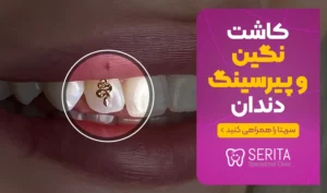 کاشت نگین و پیرسینگ دندان