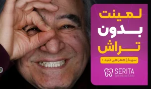 مزایا و انواع لمینت بدون تراش