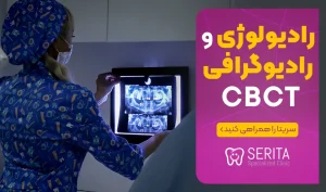 رادیولوژی و رادیوگرافی CBCT چیست؟ (عکس ایمپلنت دندان)