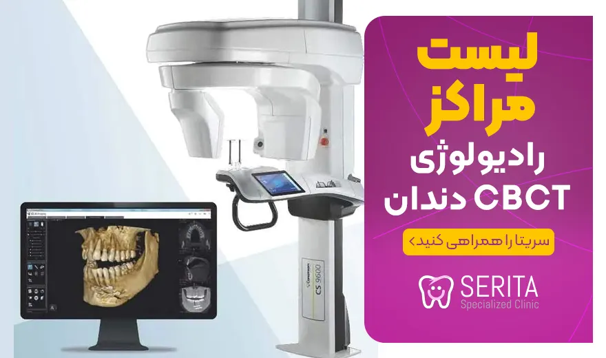 لیست مراکز رادیولوژی CBCT دندان در تهران (مراکز عکس CBCT)