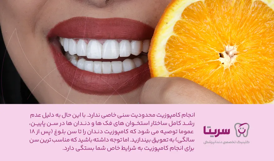 مناسبترین سن برای کامپوزیت دندان