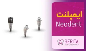 بررسی ایمپلنت نئودنت (Neodent)