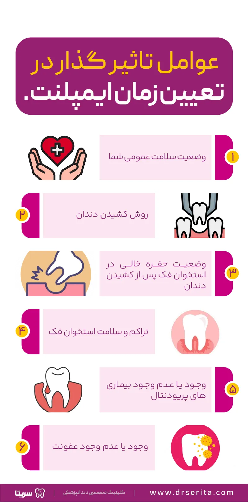 بهترین زمان برای ایمپلنت ندان و عوامل موثر در تعیین زمان ایمپلنت دندان