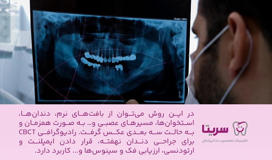 مراکز رادیولوژی CBCT