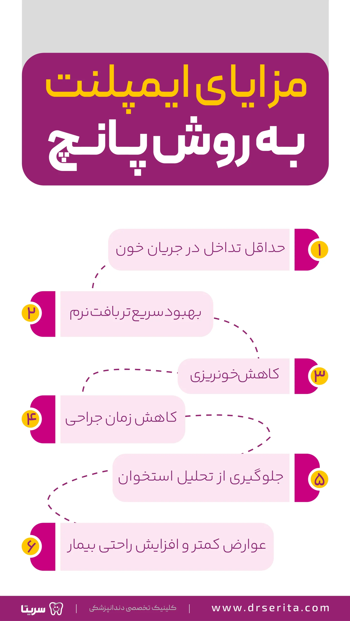 مزایای ایمپلنت دندان به روش پانچ