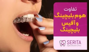 تفاوت بین آفیس بلیچینگ و هوم بلیچینگ