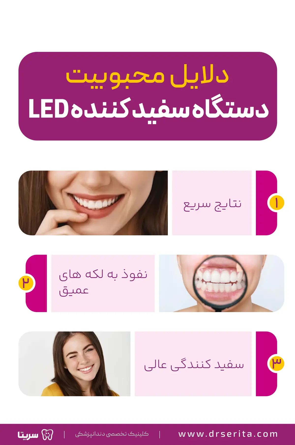 اینفوگرافیک دستگاه سفید کننده LED، نتایج استفاد از دستگاه سفید کننده LED