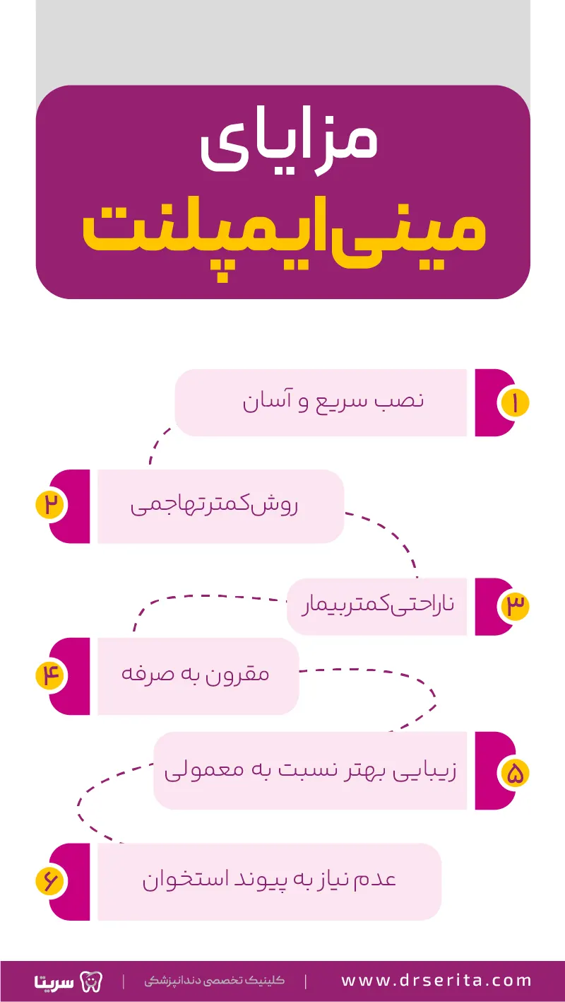 مزایای مینی ایمپلنت