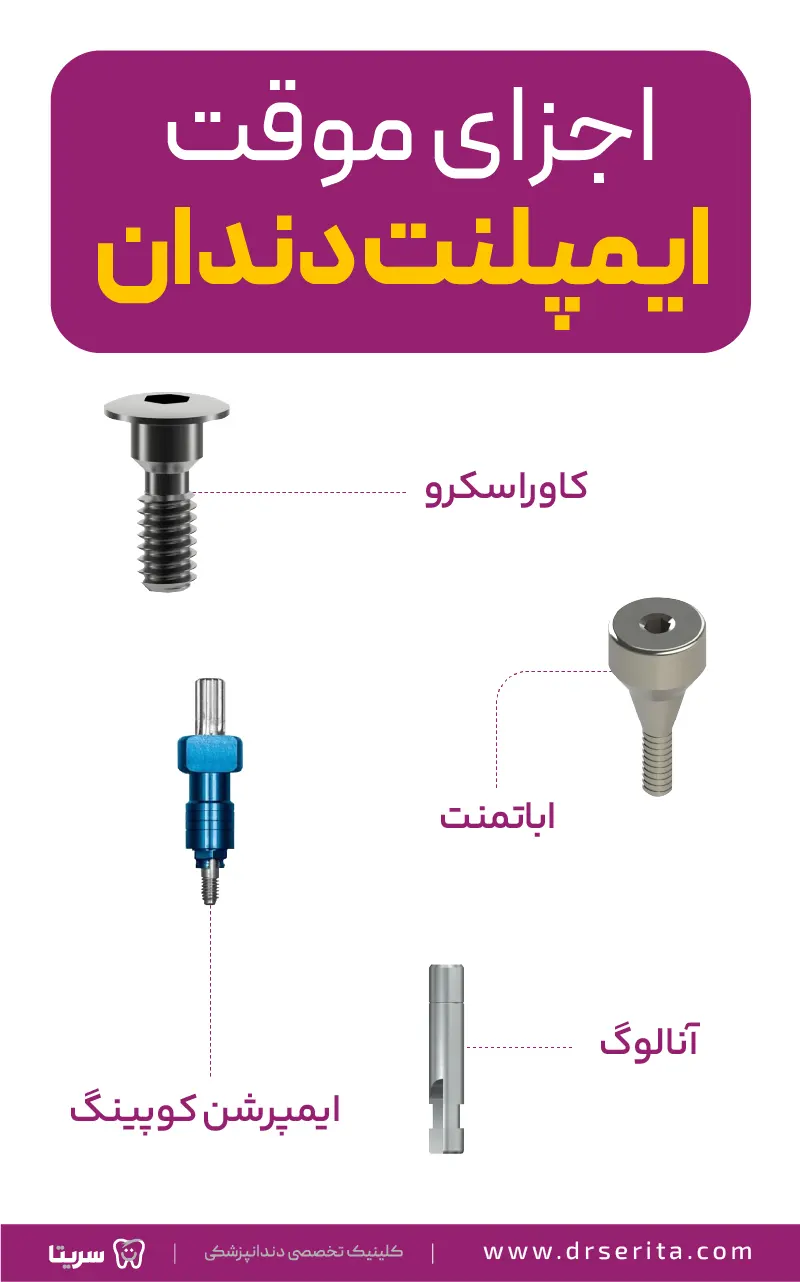 اجزای موقت ایمپلنت دندان